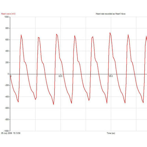 Heart Rate and Pulse Waveform